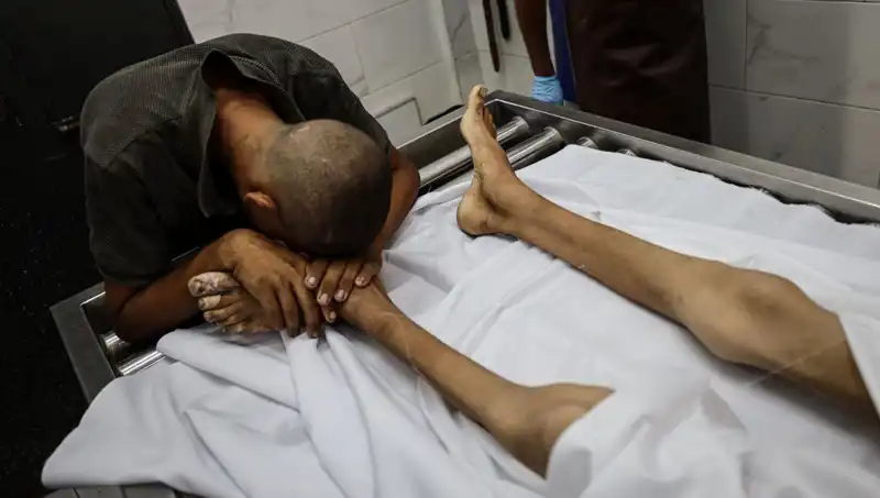 Gazze’de Açlık Felaketi: Bir Çocuk Daha Hayatını Kaybetti