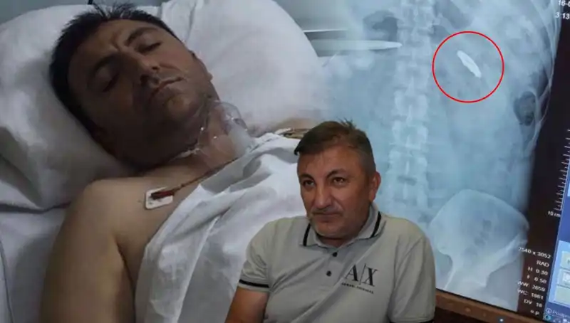 15 Temmuz'un Gölgesinde: Vücudunda Yıllarca Taşıdığı Kurşunla Yaşamak