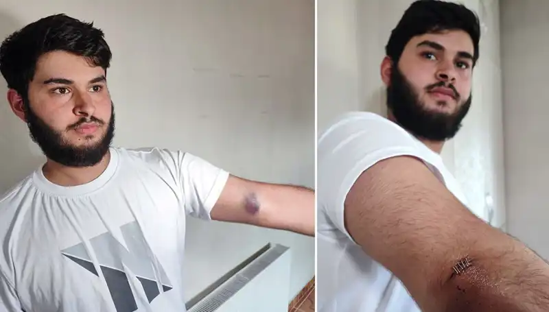 Bahçeye Kaçan Top, Mahallede Eğlenceyi Kızıştırdı: "Conolar Kamyonetle Geldi!"